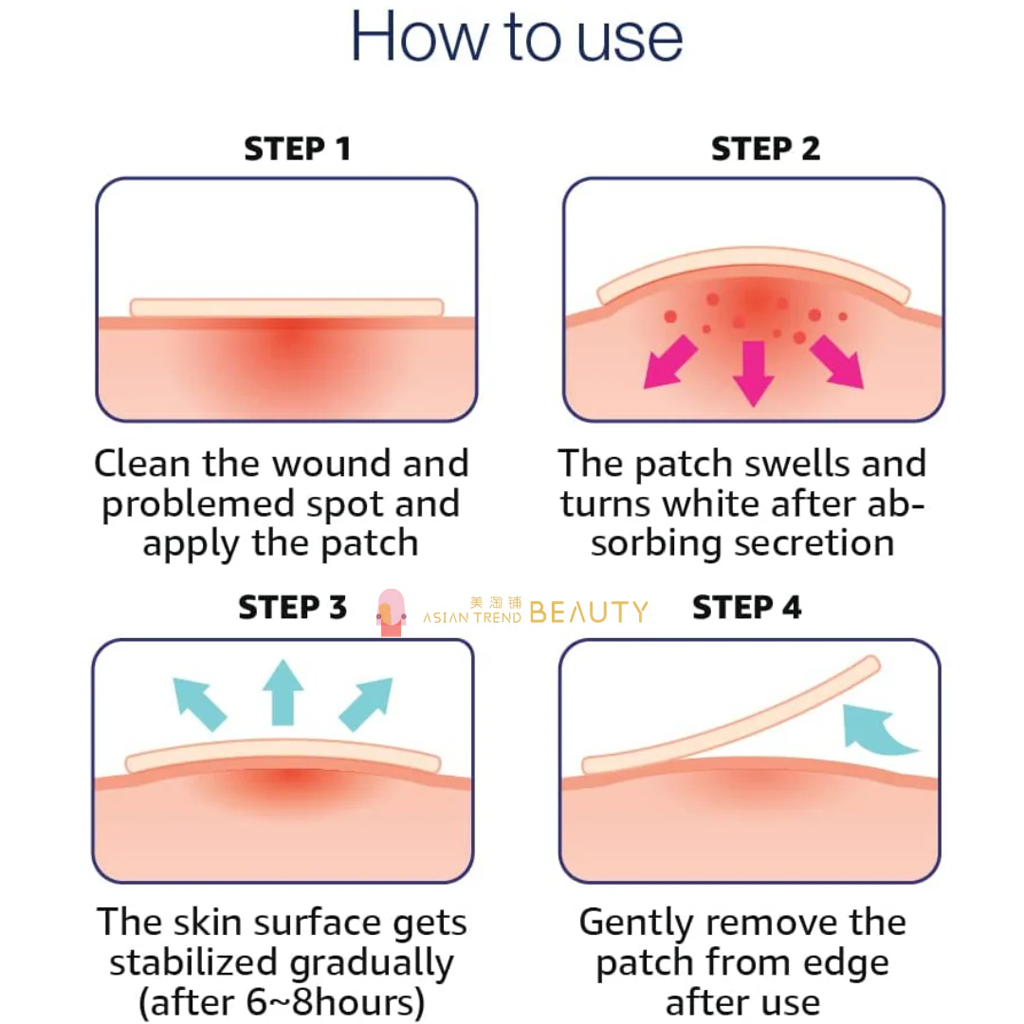 OLIVE YOUNG CARE-PLUS Scar Cover Spot Patch 81 pcs