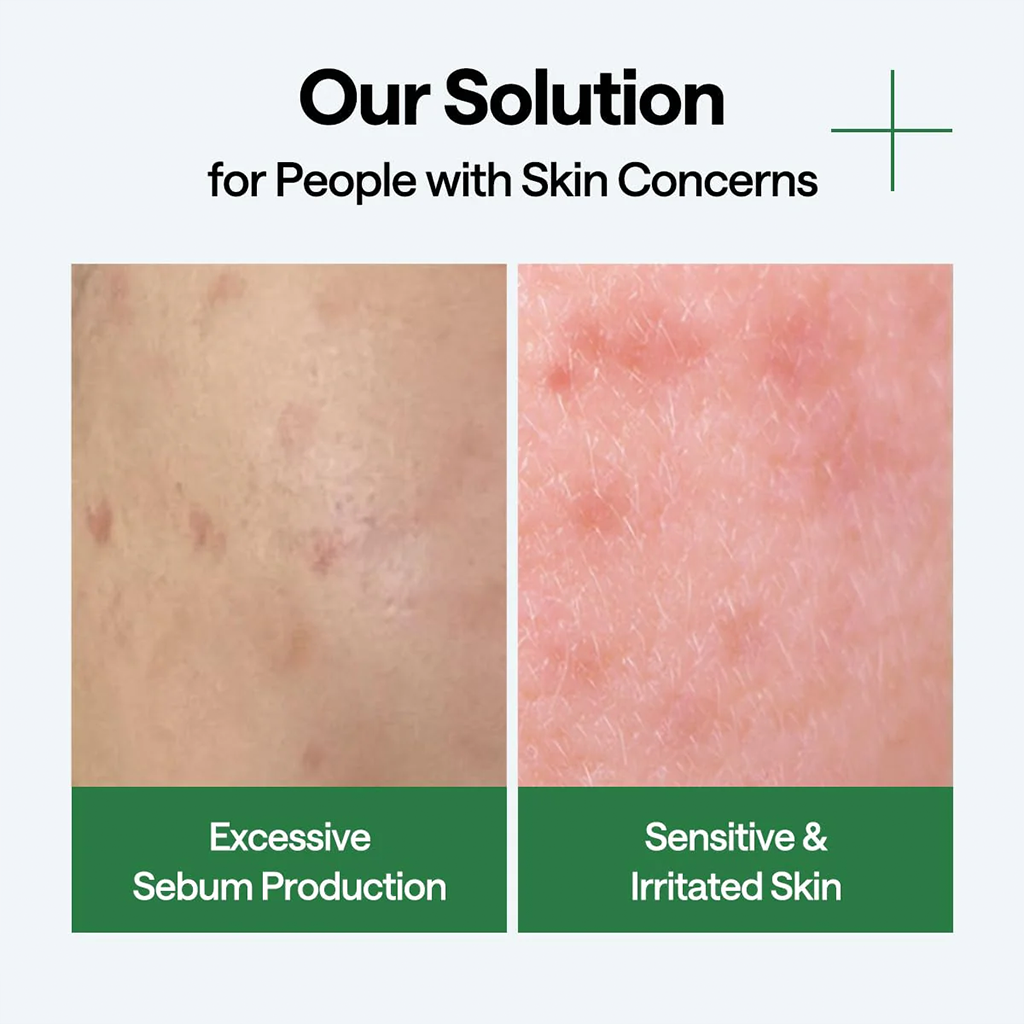 MEDIHEAL Teatree Wrapping Serum Mask 10pcs